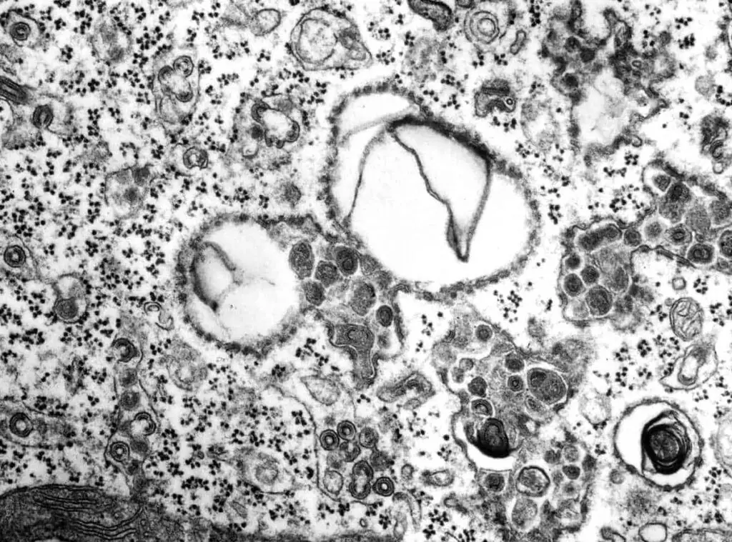Best air purifier for viruses-An electron microscope picture of virus particles